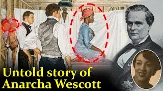 Untold Story of Anarcha Wescott | A Dark Chapter in Medical History | Hindi