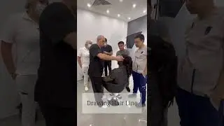 Designing Hairline Before Hair Transplant Operation