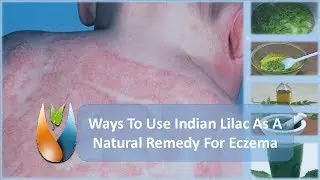 Ways To Use Indian Lilac As A Natural Remedy For Eczema
