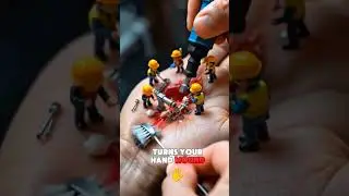 Tiny Workers Fixing a Giant Hand Wound!