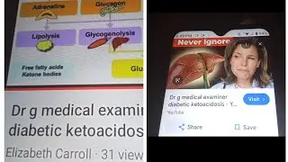 Did dr g medical examiner credit Elizabeth Carroll