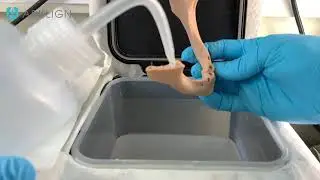 Mandibular Foramen and Mental Foramen are connected as a tunnel in the body of the Mandible.
