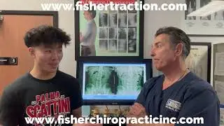Scoliosis with disc Herniation patient testimonial using Fisher Traction at Fisher Chiropractic CA.
