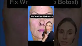 Not All Wrinkles Need Botox #dermatologistadvice