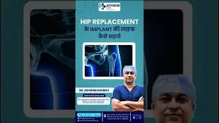 Hip Replacement में Implant की Life कैसे बढ़ाएं?#jeevandanhealth