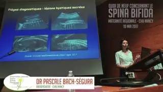 Quoi de neuf concernant le spina bifida ? -  Radiologie et imagerie