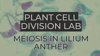 TP Division cellulaire v&eacute;g&eacute;tale : M&eacute;iose dans les anth&egrave;res de lys