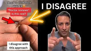 DEHYDRATION TEST: Why this did NOT work for me.