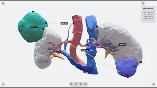 📏 BrugOne AI: 3D Tissue Measurement for Precision Surgery | JST Medics