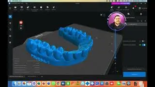 🔵 Rotación y Soportes en Chitubox | Posicionamiento Correcto de Modelos Dentales 3D
