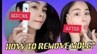 HOW TO REMOVE UNWANTED MOLE/PORTABLE MACHINE