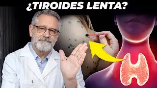 Hipotiroidismo: &iquest;Por qu&eacute; una tiroides lenta destruye las arterias en silencio?