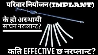 के हो अस्थायी साधन नरप्लान्ट?फाइदा र बेफाइदा केके छन?Family planning Methods norplant / implant.