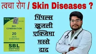 Biocombination 20 Uses in Hindi | Skin Disease, Pimples, Eczema की Homeopathy Medicine
