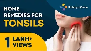 Home remedies for tonsillitis