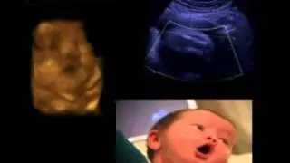 Ultrasound images of baby at 35 weeks
