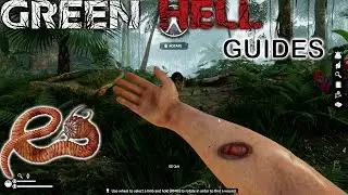 GREEN HELL: How to get rid of worms