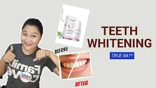 RTOPR Teeth Whitening Essence | True bang nakakaputi ng ngipin?
