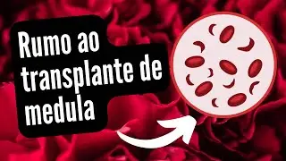 Preparação para o transplante de medula