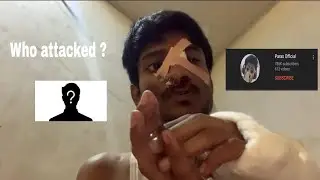 Who attacked @ParasOfficialYT , Paras singh attack video, justice for Paras