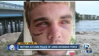 Mother accuses Jupiter police of excessive force after son Cody Ross Blankenship is arrested