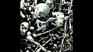(free) BONES TYPE BEAT &ldquo;KickingTheChair&rdquo; 