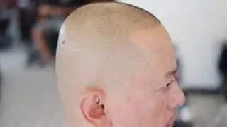 BALD HAIR