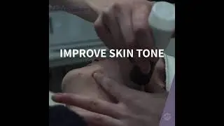 SkinBase Microdermabrasion Benefits