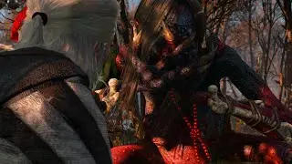 The Witcher 3 : Return to Crookback Bog : Episode 13