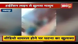 Jabalpur : बिल्डर की लापरवाही उजागर, High Tension Line से झुलसा मासूम | SP ने दिया कार्रवाई का भरोसा