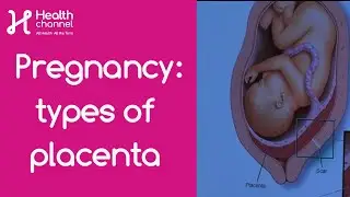Pregnancy: Types of Placenta