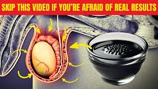 SHOCKING! 5 Black Seed Oil Benefits For Men's Health (90% Men Not Know)