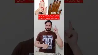 hand foot whitening cream #drzeeshan #handcream #skincare #viralshortvideo