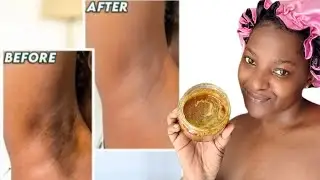 DIY BODY BRIGHTENING SCRUB FOR DARK ARMPITS,DARK INNER THIGHS, DARK NECK, DARK FEET #diyremedies
