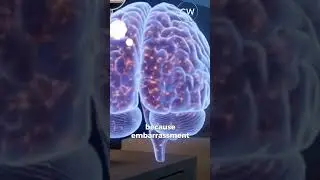 Why Your Brain Replays Embarrassing Moments at Night?