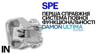 Брекет-система DAMON ULTIMA SYSTEM від ORMCO