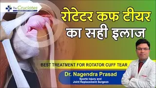 रोटेटर कफ टीयर का सही इलाज़ I Best treatment for rotator cuff tear without surgery #RotatorCuffHindi