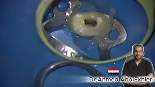 Endodontic Treatment reduced upper first premolar step by step #endodontics #dental
