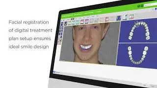 SureSmile Aligner Overview. Clinically Proven. Clinician Controlled.