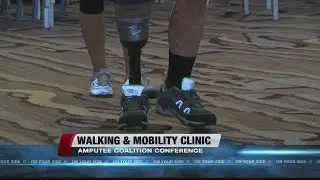 Amputee Clinic