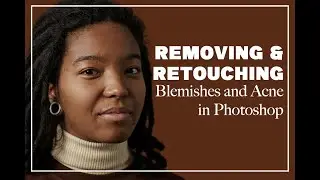 How to Clear Up Skin Blemishes/Acne in Photoshop