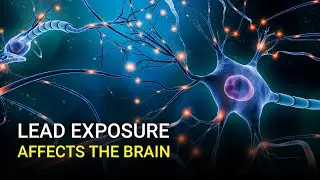 Half of Americans have lower IQ scores due to lead exposure, study finds
