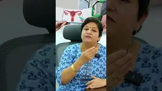 Copper T Effect & Side Effects Explained! Dr. Abinaya Copper T Effect & Side Effects Explained!