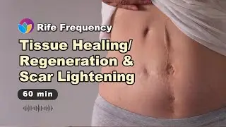 LIGHTEN SCAR & TISSUE REGROWTH | Rife Freq for tissue Regeneration & Scar Fading