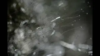 Flesh Rotting Fungus! Timelapse 4K