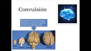 Convulsiones en perros y gatos, epilepsia, Neurólogo Dr. Bugarin