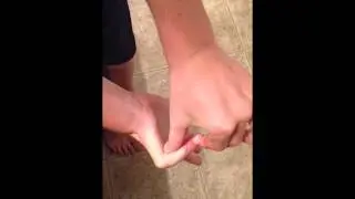 What it's like to be triple jointed