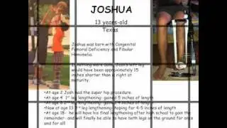 Paley_Advanced_Limb_Lenghening_Institute.flv