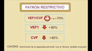 Interpretación básica de espirometría