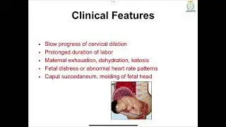 Abnormal labor and deliveries